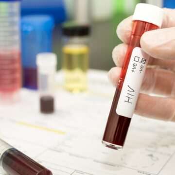 img-339 Femeie despăgubită cu 145.000 de euro după ce a contractat HIV într-un laborator de cercetare