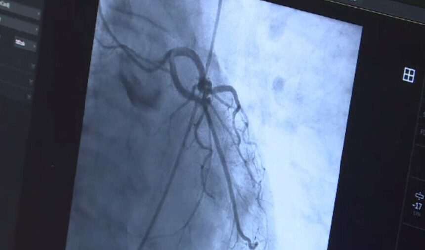 img-1177 Intervenție complicată la Institutul CC Iliescu