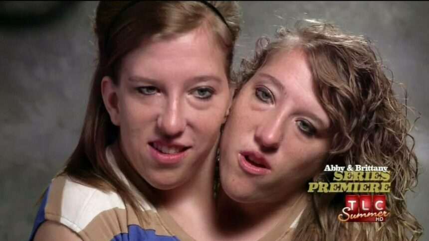 img-1613 Geamăna siameză Abby Hensel s-a căsătorit. Imagini cu ea și sora Brittany în rochie de mireasă