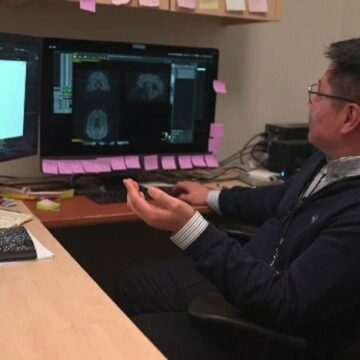 img-179 Tratament revoluționar pentru tratarea depresiei severe. Cum funcționează un peacemaker pentru creier