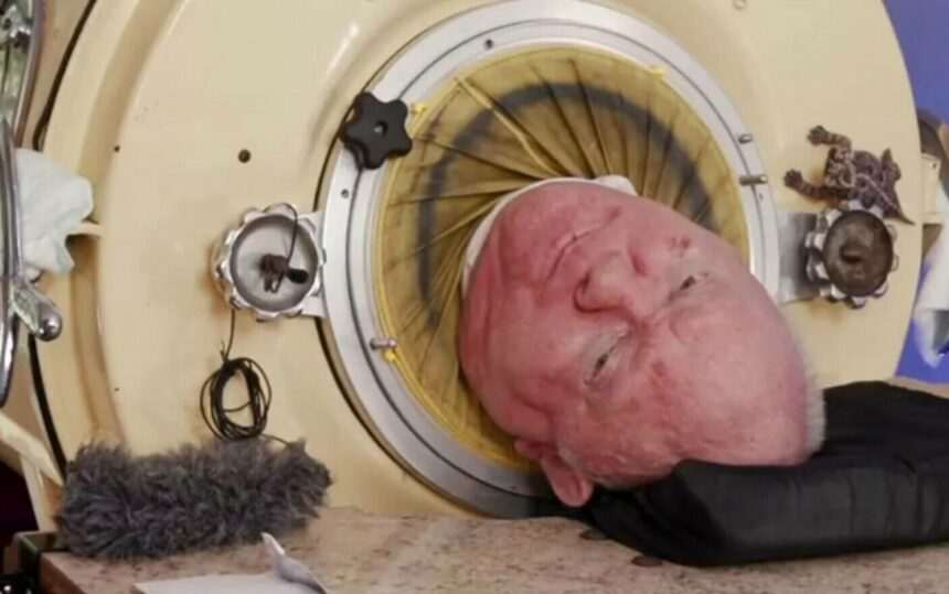 img-227 Povestea uimitoare a lui Polio Paul – Bărbatul care a trăit într-un „plămân” de fier timp de 70 de ani