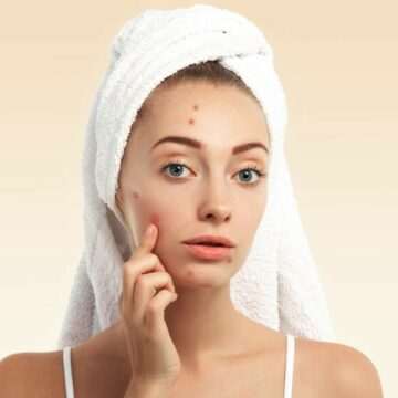 img-357 Substanță cancerigenă descoperită în produse împotriva acneei de la mărci cunoscute