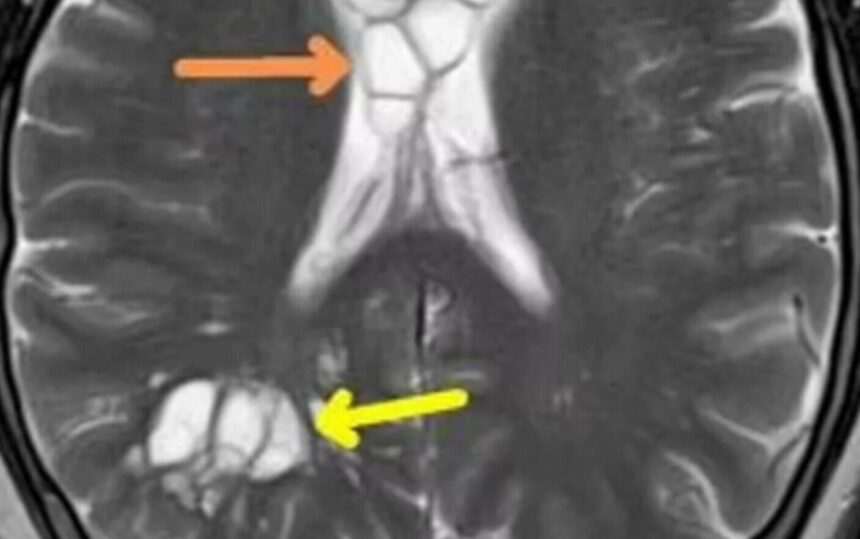 img-567 Descoperirea șocantă a unui bărbat după ce a consumat bacon