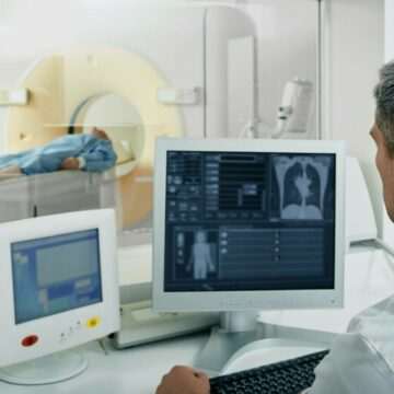 img-647 Descoperirea șocantă a unei femei care avea dureri de cap: o tumoare de 5 cm pe creier