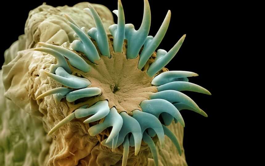 Impactul consumului de slănină insuficient gătită: Tenii găsite în creierul unui bărbat