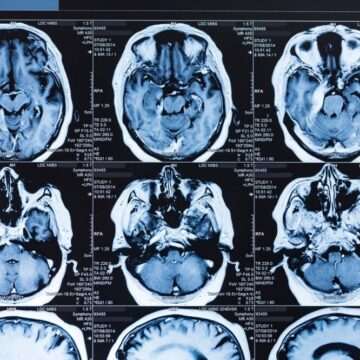 img-1097 Impactul categoriilor de angajați asupra sănătății creierului la bătrânețe