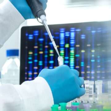 img-1196 Descoperirea uluitoare a unui maxilar uman în colecția de pietre a fiului unei femei