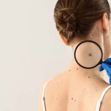 Vaccinurile împotriva cancerului – o speranță reală pentru pacienți