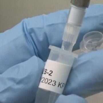 img-1597 Marea Britanie testează primul vaccin împotriva cancerului de piele. Cum este folosită inteligența artificială