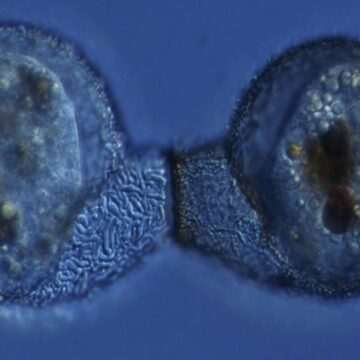 img-43 Riscul prezenței amibei mâncătoare de creier în apele din Marea Britanie