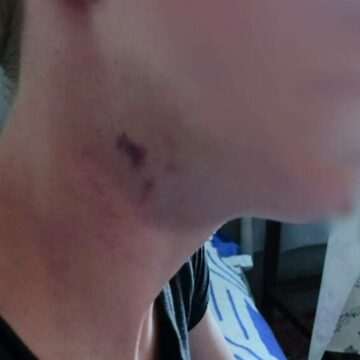 img-553 Elev din Bacău, bătut și umilit de colegii de clasă. Părinții cer măsuri ferme împotriva bullying-ului