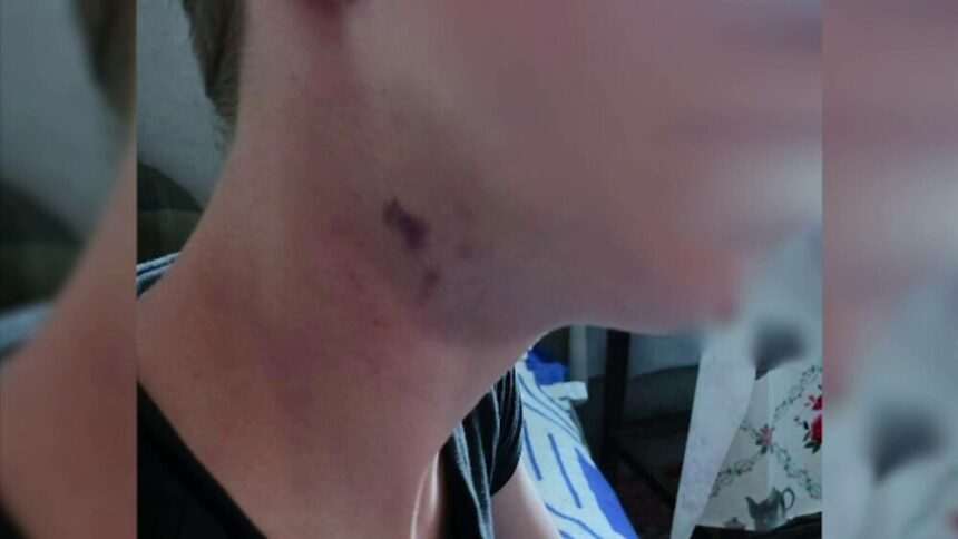 img-553 Elev din Bacău, bătut și umilit de colegii de clasă. Părinții cer măsuri ferme împotriva bullying-ului