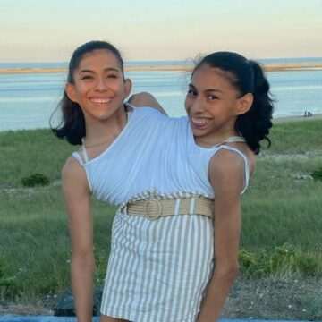 img-566 Gemene siameze Carmen și Lupita Andrade – curiozități și răspunsuri