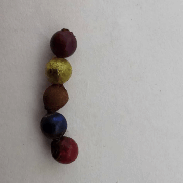 img-80 Tragedie: Fetița de doi ani a unor români a murit după ce a înghițit bile magnetice