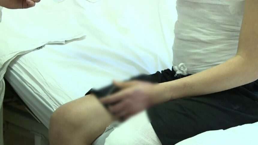 img-901 Prevenirea și tratarea arsurilor la copii – o prioritate în România