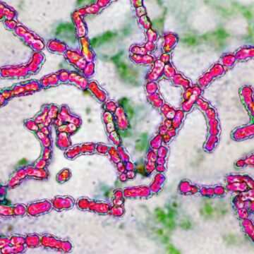 img-116 Bacterie ‘mâncătoare de carne’ face ravagii în Japonia