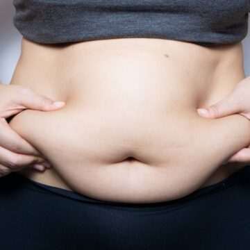 Obezitatea – boală ce poate fi tratată pentru prevenirea cancerului de colon