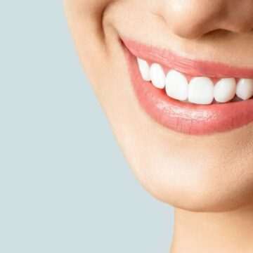 img-62 Importanța unei mușcături corecte și tratamentul ortodontic