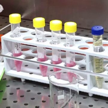 img Tinerii si riscurile legate de relatiile intime neprotejate