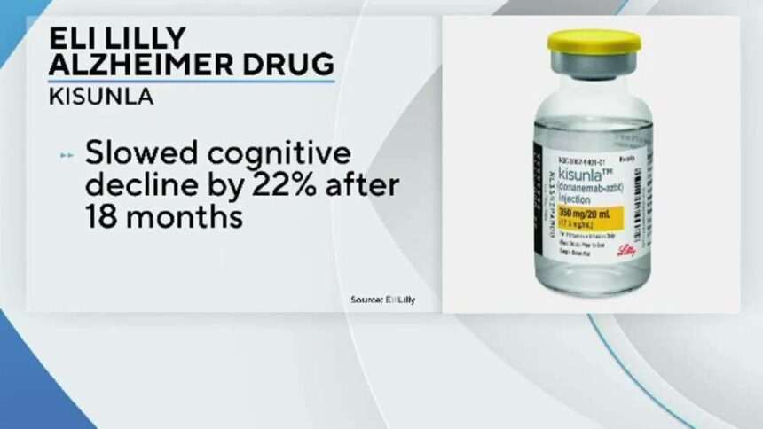 Un nou tratament pentru boala Alzheimer a primit avizul autoritatilor medicale din SUA