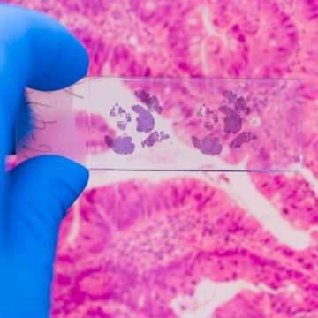 img-243 Produsele clasificate ca fiind cancerigene de către OMS