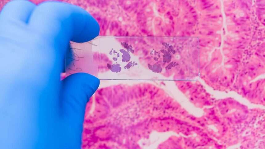 img-243 Produsele clasificate ca fiind cancerigene de către OMS