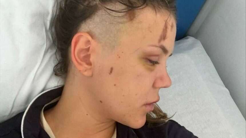img-250 Diagnostic crunt pentru Emily Burghelea, după accidentul din Mauritius