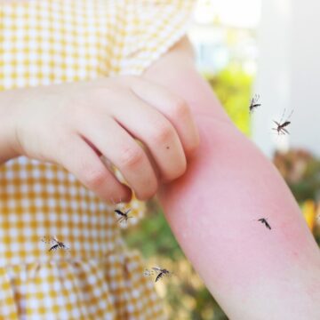 img-729 Sezonul țânțarilor în 2024: Cum îi poți evita și ce boli pot transmite