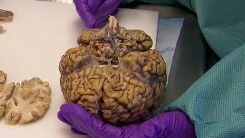 img Impactul fragmentelor de plastic asupra organismului uman