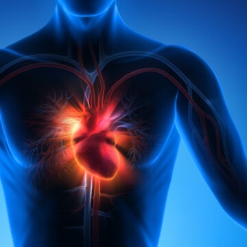 Studiul care relevă asocierea dintre factorii de risc cardiovascular și migrene