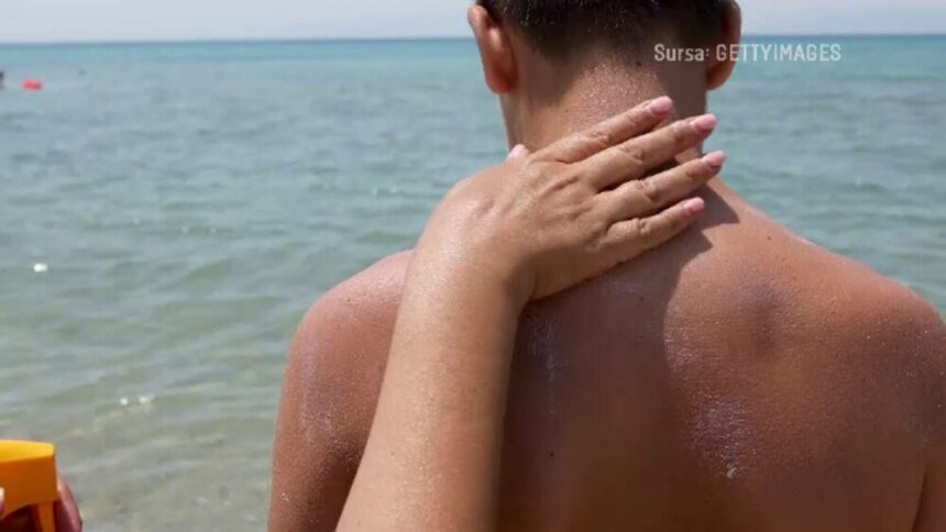 Melanomul – boala agresivă care afectează tot mai mulți români