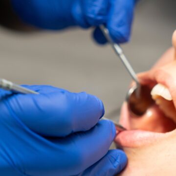 Reconstrucția osoasă pentru implanturi dentare