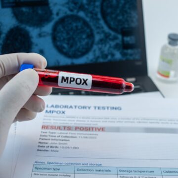 img OMS declară epidemia de mpox urgenţă de sănătate publică de interes internațional