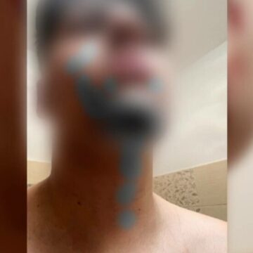 img Anchetă internă în cadrul IPJ Mureș. Un adolescent acuză că a fost bătut de doi agenți de poliție