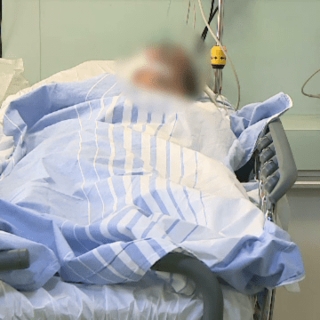 img Bărbatul mușcat de păianjen în Egipt și diagnosticat cu fasciită necrotizantă