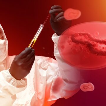 img Variola maimuței – cum te poți proteja de virusul mpox