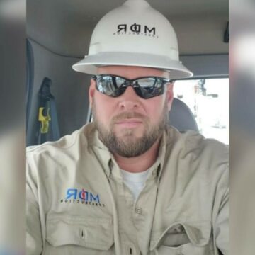 img Revolutia medicala: Transplant total de ochi si partial de fata – Un pas inainte in chirurgia reconstructiva