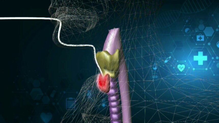 img Premieră la Spitalul Elias: Operație de scoatere a tiroidei fără cicatrice vizibilă