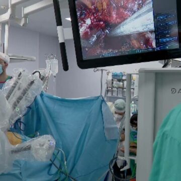 img Premiere chirurgicale în operațiile glandei tiroide, fără urme vizibile