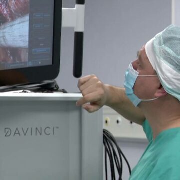 img Impactul fumatului asupra riscului de cancer la vezică urinară