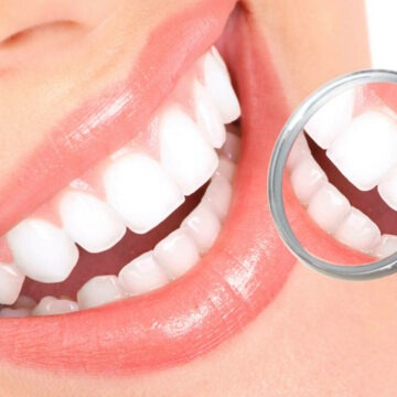 img Metoda All on 4 implant – Recapată-ți zâmbetul perfect în doar 24 de ore