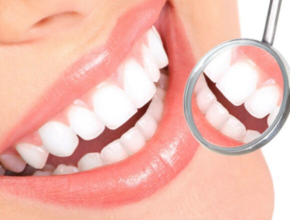 Metoda All on 4 implant – Recapată-ți zâmbetul perfect în doar 24 de ore