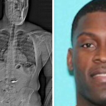 img Hoț din SUA prins cu diamante în stomac