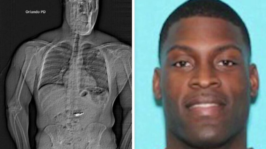 img Hoț din SUA prins cu diamante în stomac