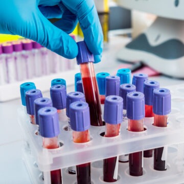 img Cât de aproape sunt oamenii de știință de a produce sânge artificial. Soluția care ar putea salva vieți