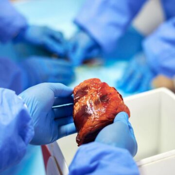 Scandal uriaș de trafic de organe în Kenya