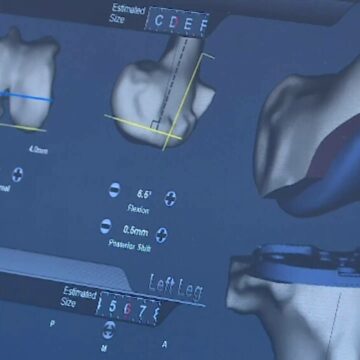 Metoda modernă de tratament a durerilor la umăr, genunchi, șold sau gleznă fără operație și pastile