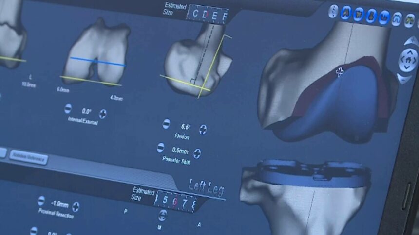 img Metoda modernă de tratament a durerilor la umăr, genunchi, șold sau gleznă fără operație și pastile